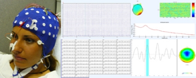 Electroencephalography (EEG)